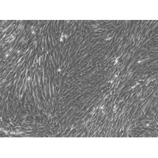 Human Bronchial Fibroblasts (HBF)